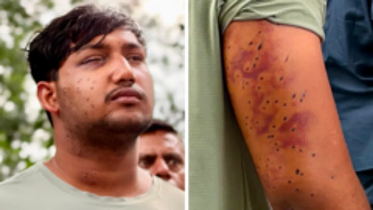 భారత రాజధానిలో నిరసనకారులపై పెల్లెట్ గన్ గాయాలు: నిపుణుల నిర్ధారణ